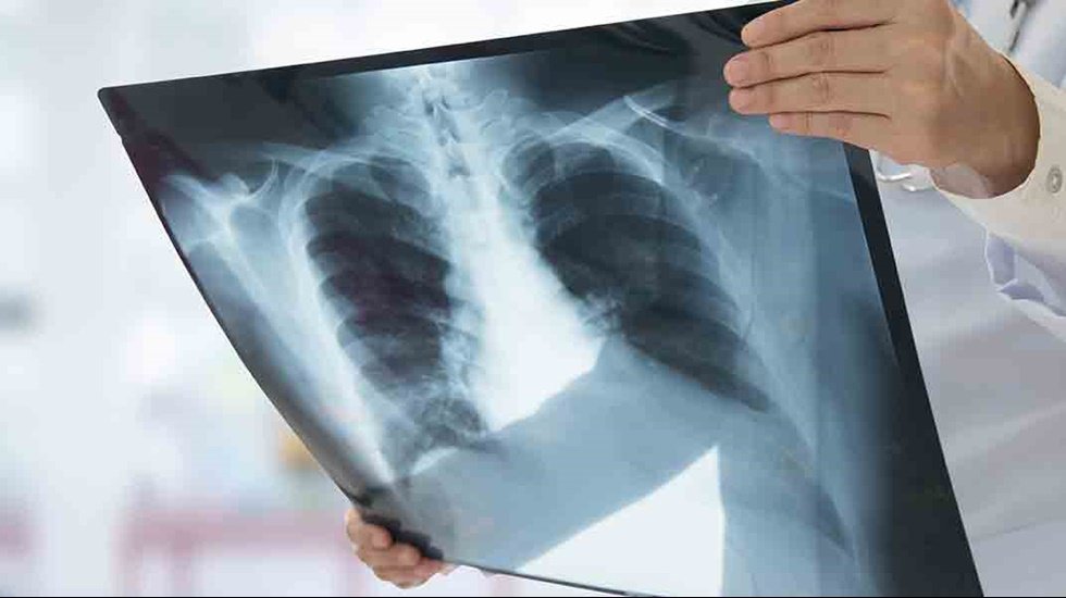 Yeni yılla birlikte zat&uuml;rre salgını alarm veriyor