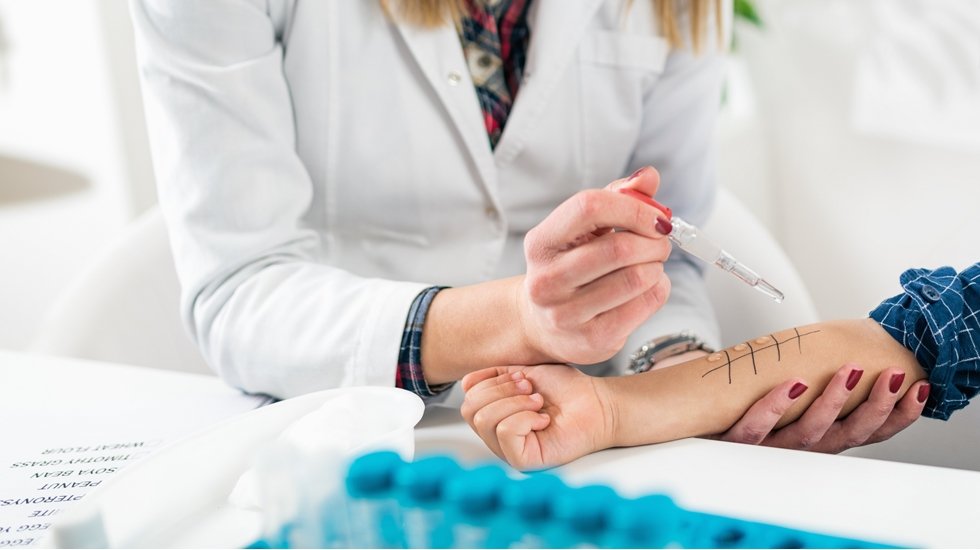 Alerji testinin pozitif &ccedil;ıkması aktif bir alerji olduğunu g&ouml;stermeyebilir!