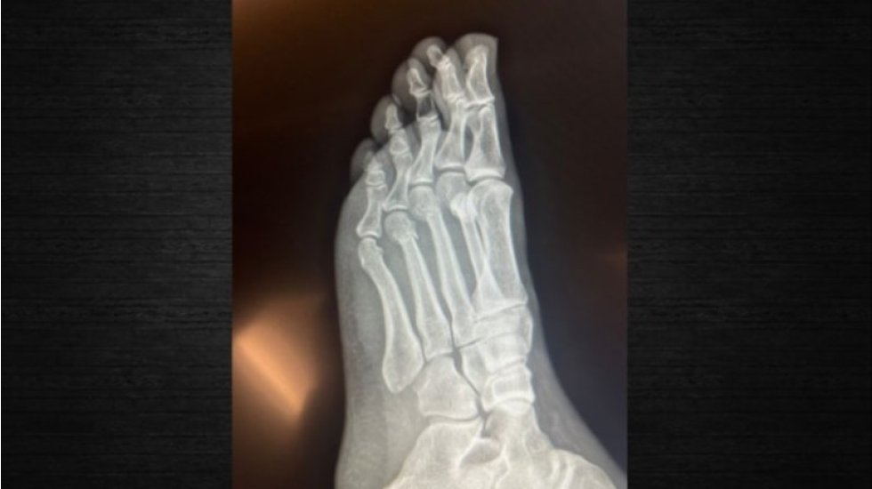 CHP lideri &Ouml;zg&uuml;r &Ouml;zel r&ouml;ntgen filmlerini paylaştı