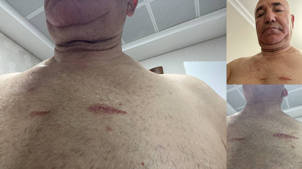 CHP Milletvekili Mahmut Tanal'a polis şiddeti...